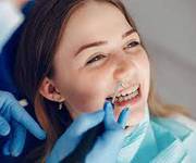 Tooth Extraction In Maryland